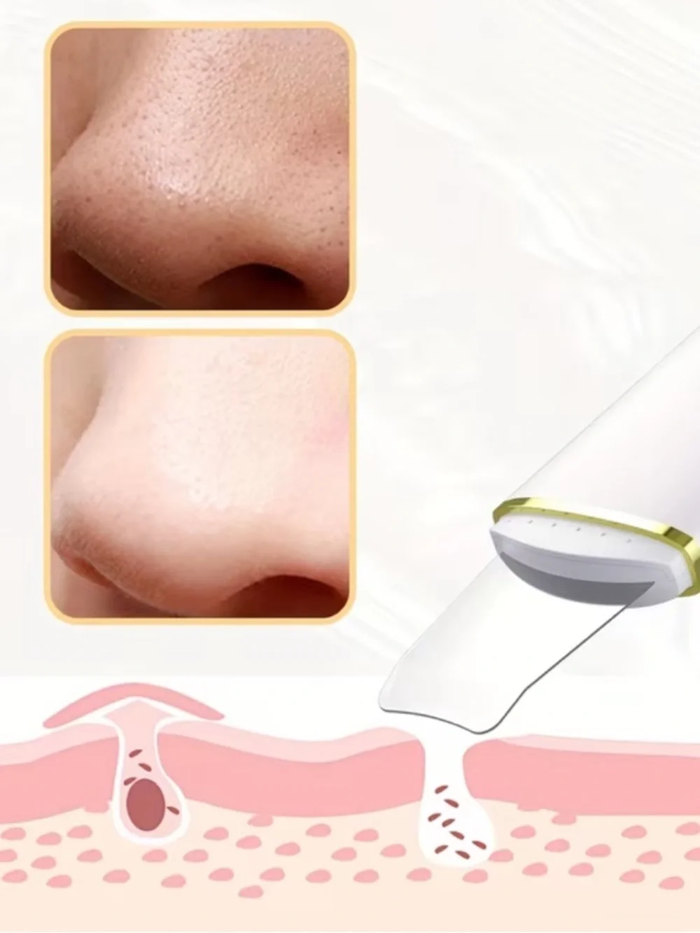 Pore Extractor Face Spatula Deep Cleansing for Facial Skincare